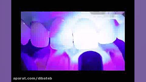 ترمیم دندان با کامپوزیت به روش...