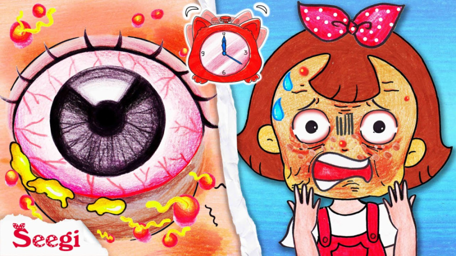 ایده کارتونی باربی  درمان جوش...