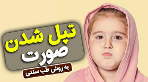 چاق شدن صورت با ترفندهای طب سن...
