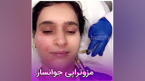 مزوتراپی با کوکتل جوانساز