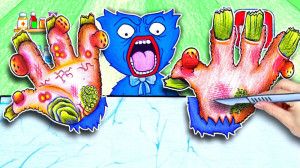 درمان قارچ و آکنه دست هاگی واگ...