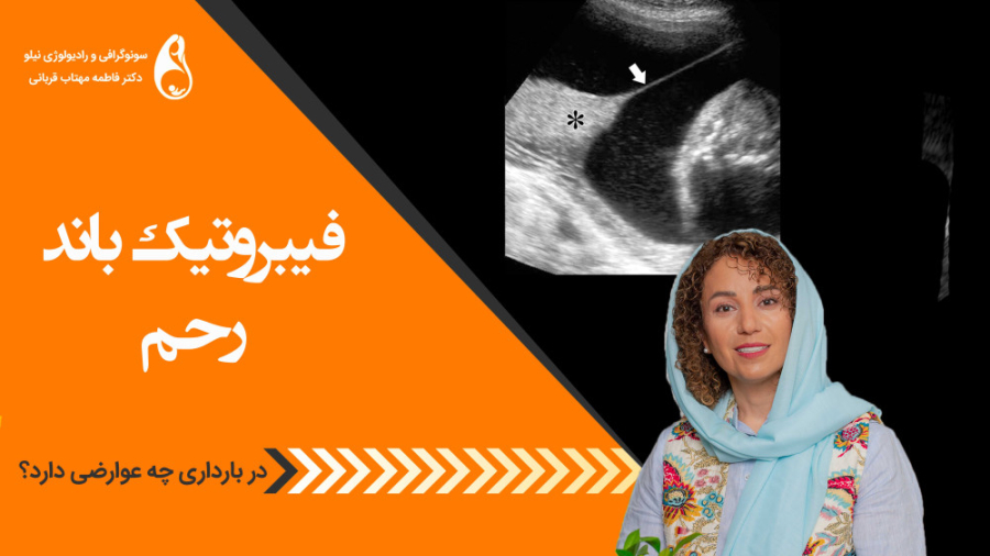 فیبروتیک باند در بارداری