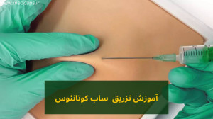 آموزش تزریق ساب کوتانئوس
