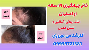 درمان خانگی ریزش مو
