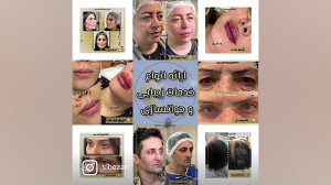 کلینیک زیبایی و جوانسازی سیب ز...