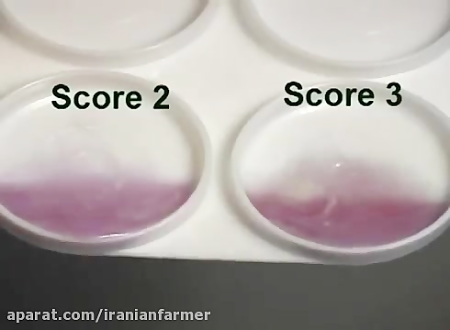 شناسایی ورم پستان با روش CMT