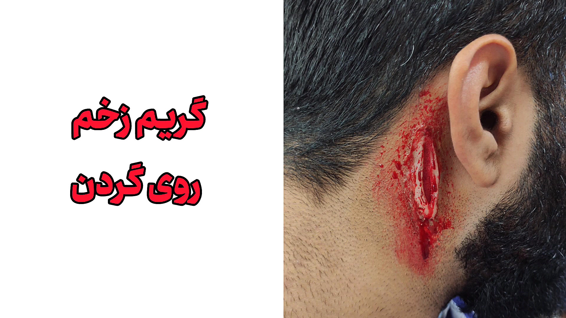 گریم زخم و سوختگی بیمارنما