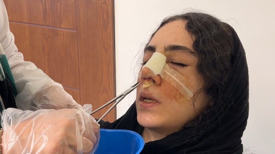 جراحی زیبایی بینی | دکتر فرشید...