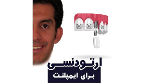 ارتودنسی برای ایمپلنت | دکتر د...