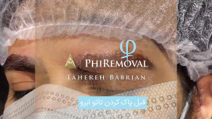 خروج رنگ ریمو تاتو