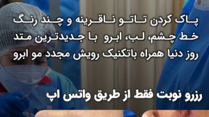 پاک کردن تاتو شهر رشت