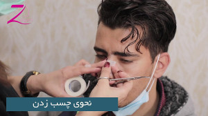 نحوه چسب زدن بینی