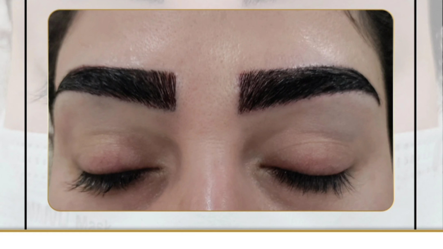 کاشت ابرو دائمی