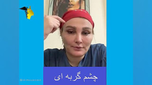 چشم گربه ای