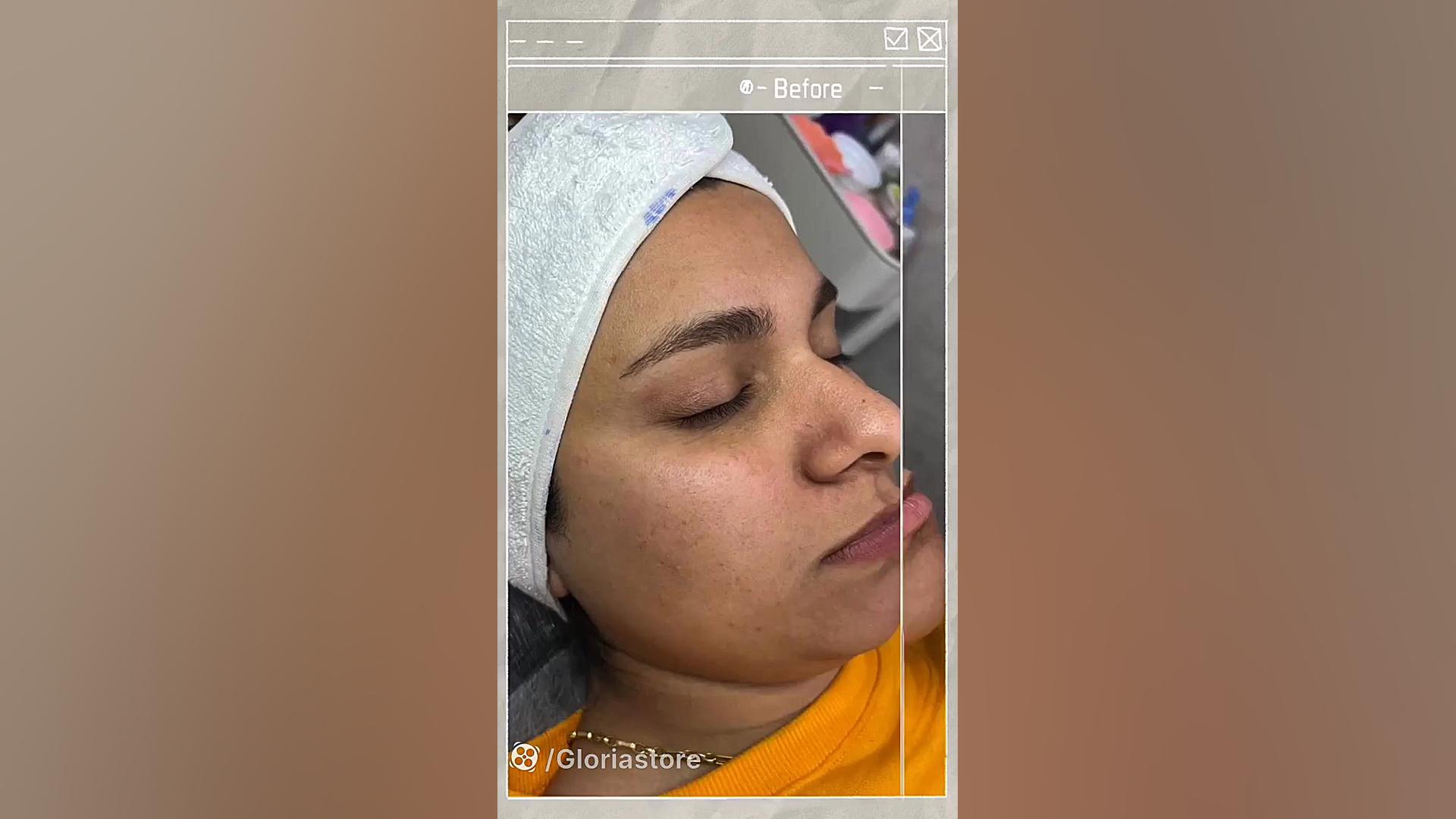 فیشال حرفه ای پوست با برند تخص...