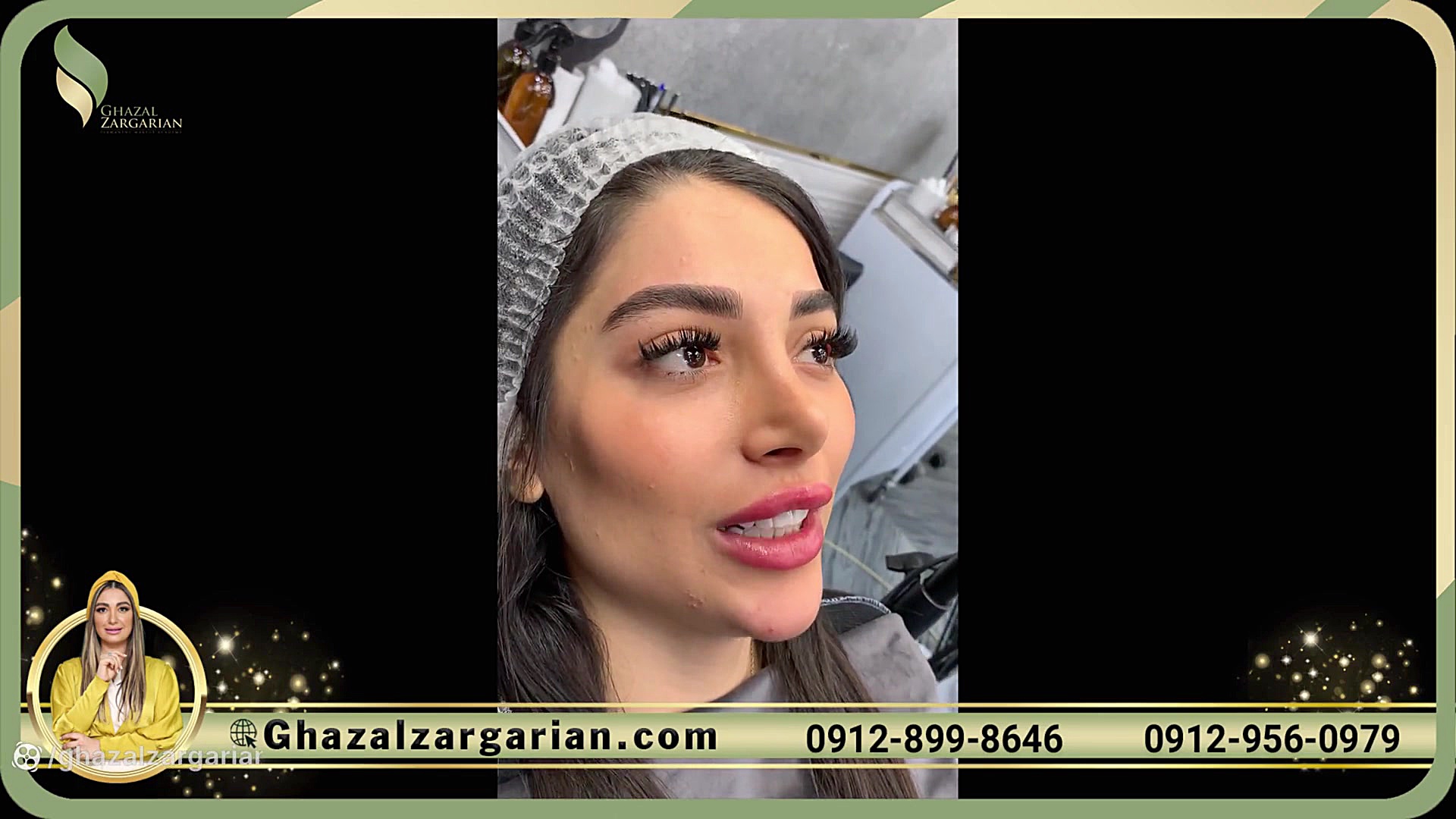 فیبروز ابرو دخترانه در مرکز غز...