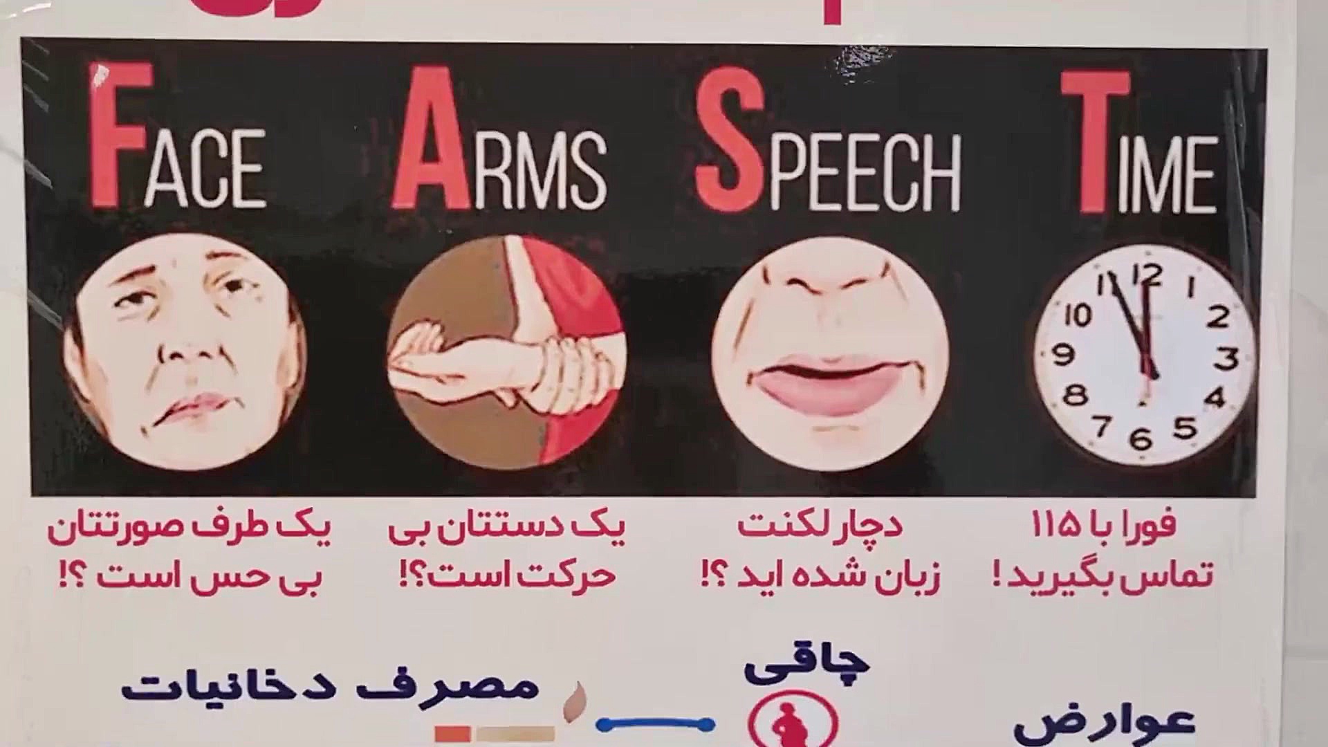 همه چیز در مورد سکته مغزی