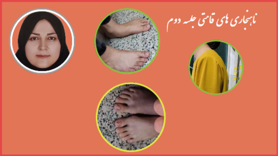 ناهنجاری قامتی قسمت دوم