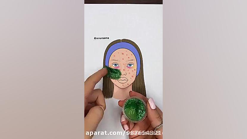 روتین پوستی (لطفا توضیحات را ب...