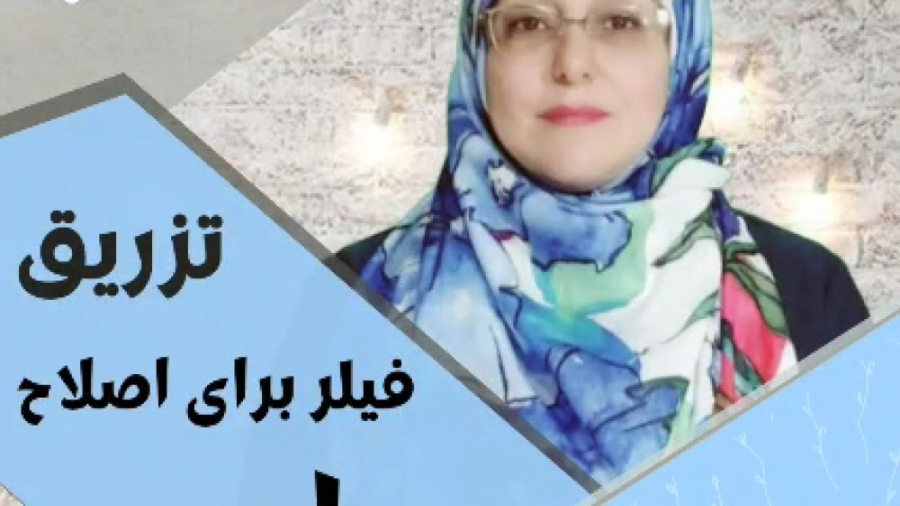 تزریق فیلر لب طبیعی