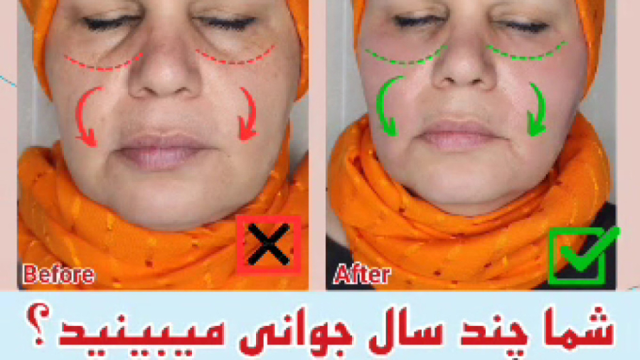 ️شما چندسال جوانی می بینید️