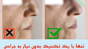 بدون جراحی،بینی ات رو صاف کن