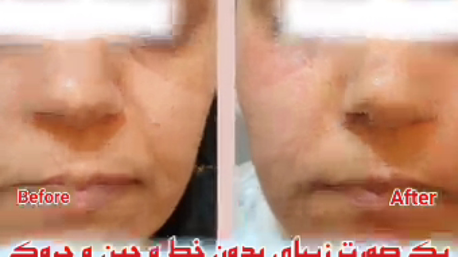 یک صورت زیبای بدون خط و چین و...