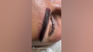 کاشت ابرو قابل رشد