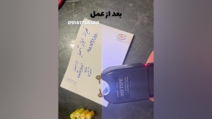 تعمیر شوکر پلیس