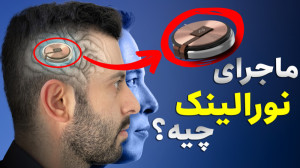 برای نصب تراشه روی مغزتان آماد...