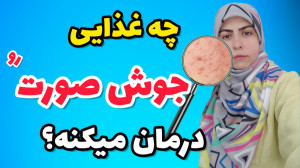 چه غذاهایی باعث ایجاد جوش در ص...