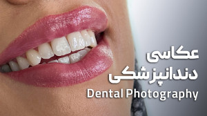 عکاسی دندانپزشکی | Dental Phot...