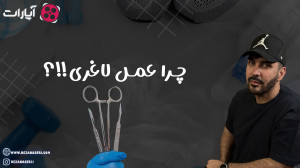 چرا عمل لاغری!!؟