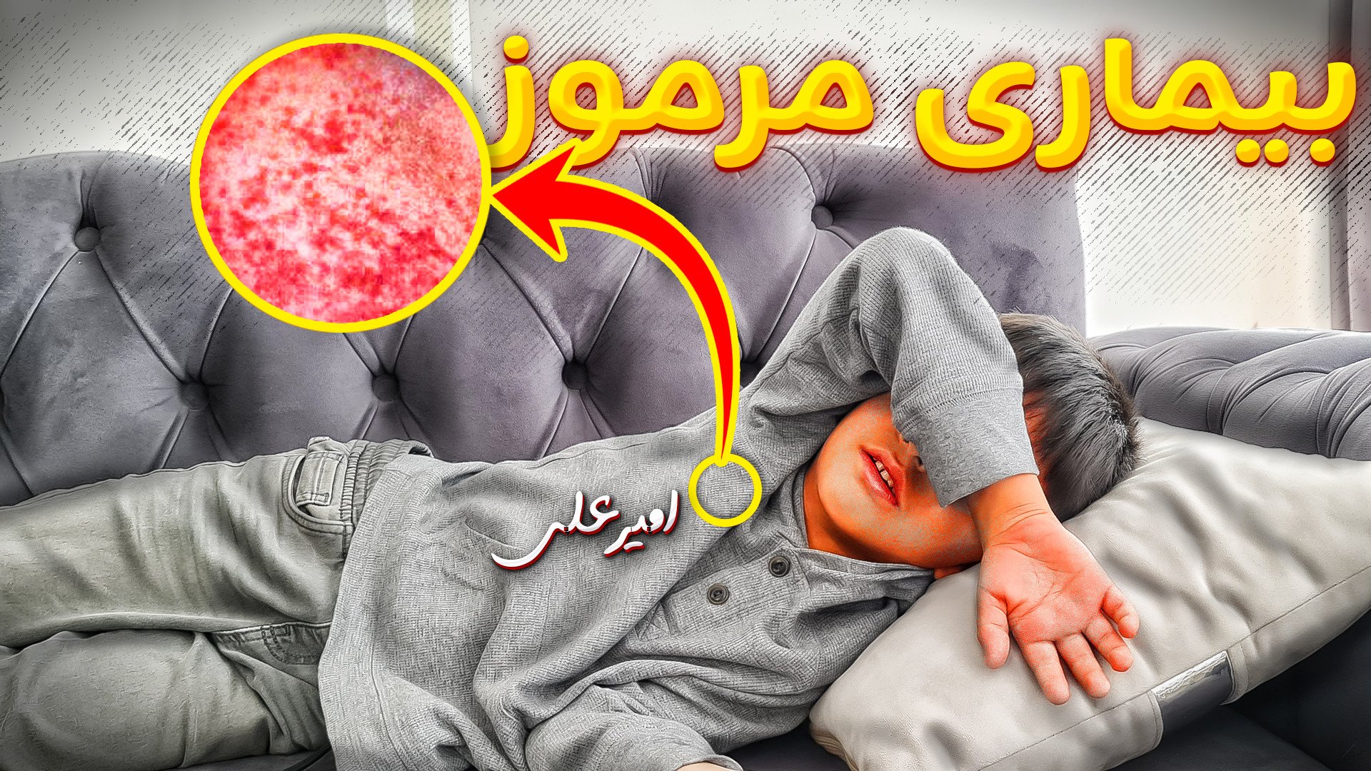 جریان بیماری عجیب امیرعلی | فق...