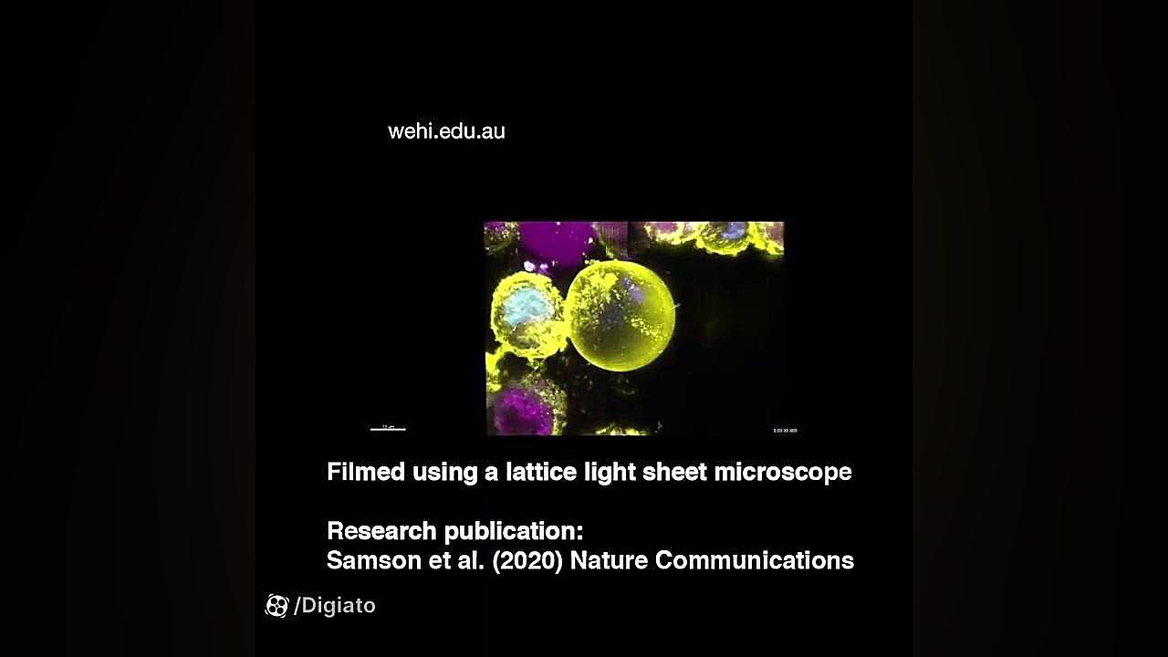 وقوع فرایند نکروپتوز در سلول‌ه...