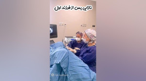 نازایی پس از فرزند اول