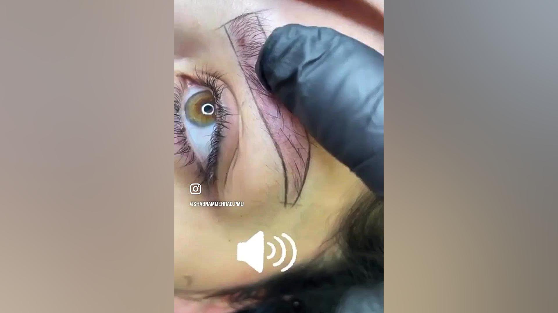 مرکز تخصصی فیبروز اصفهان،بهتری...