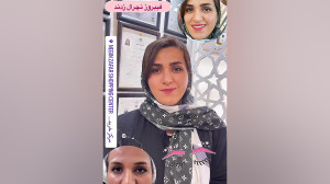 مرکز تخصصی ابرو چشم لب