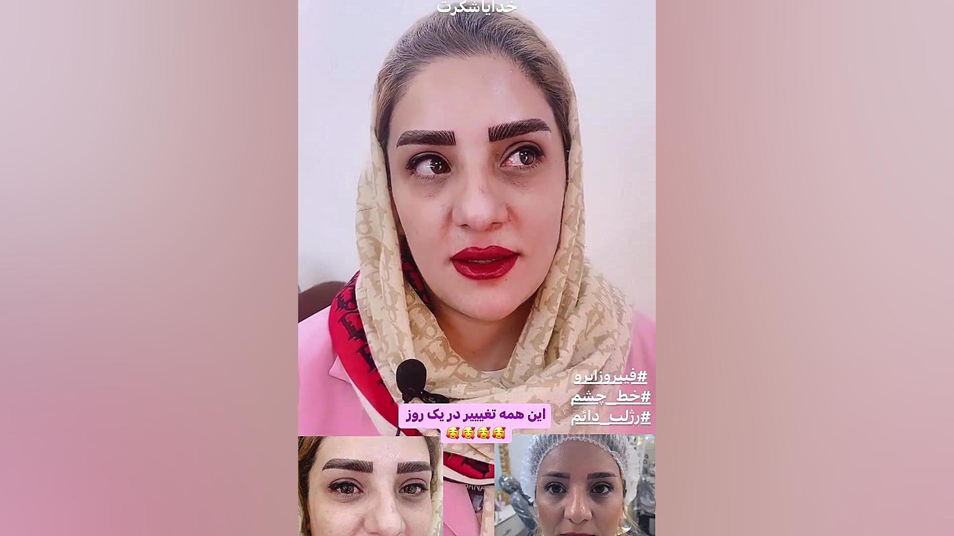 مرکز تخصصی ابرو چشم لب