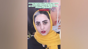 مرکز تخصصی ابرو چشم لب