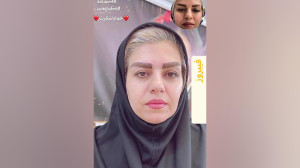 مرکز تخصصی ابرو چشم لب