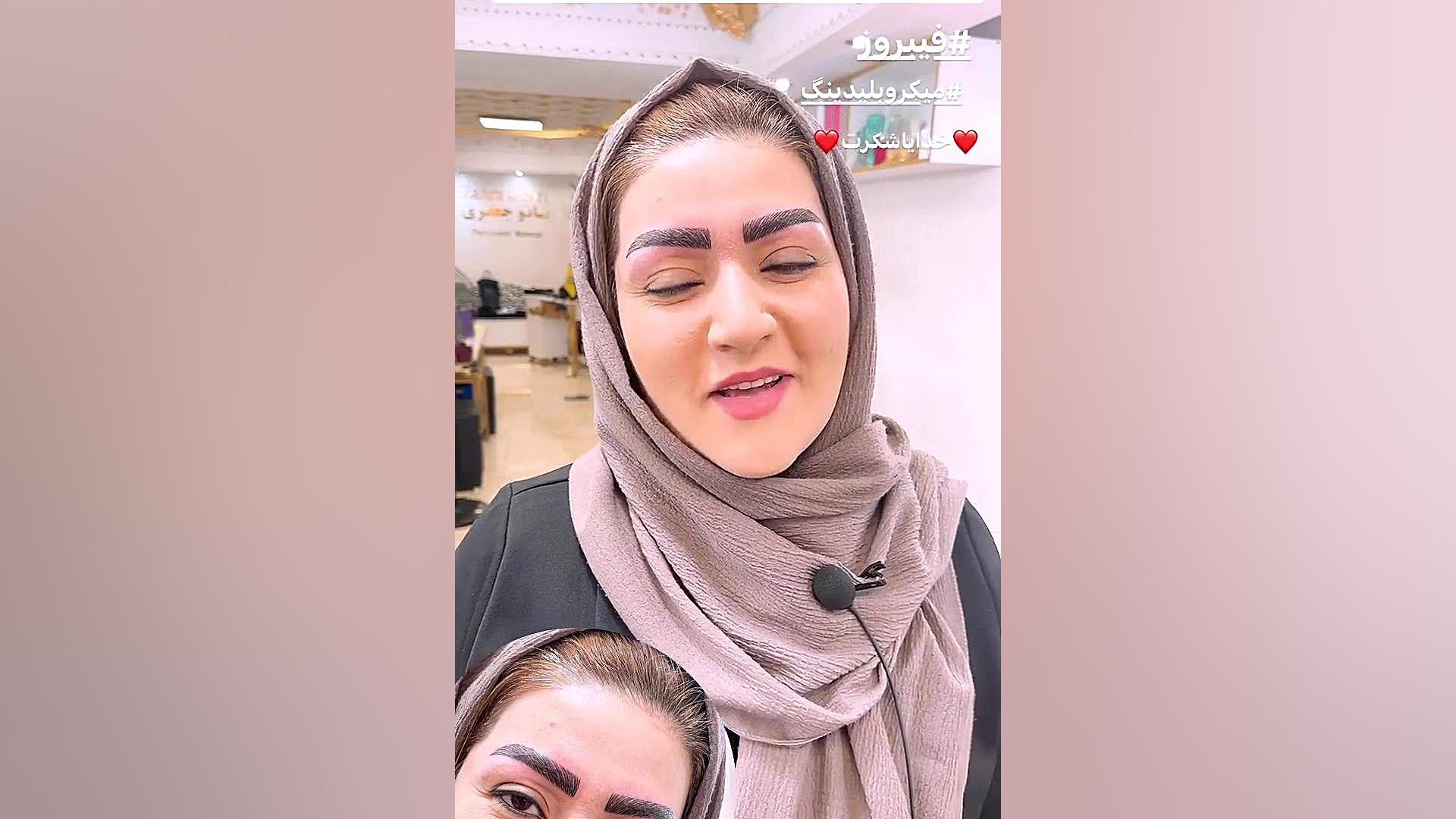 مرکز تخصصی ابرو چشم لب