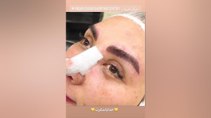 مرکز تخصصی ابرو چشم لب