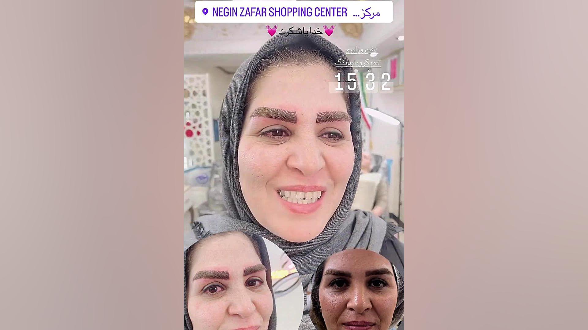 مرکز تخصصی ابرو چشم لب