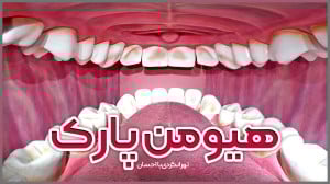 هيومن پارک (سفر به درون بدن ان...