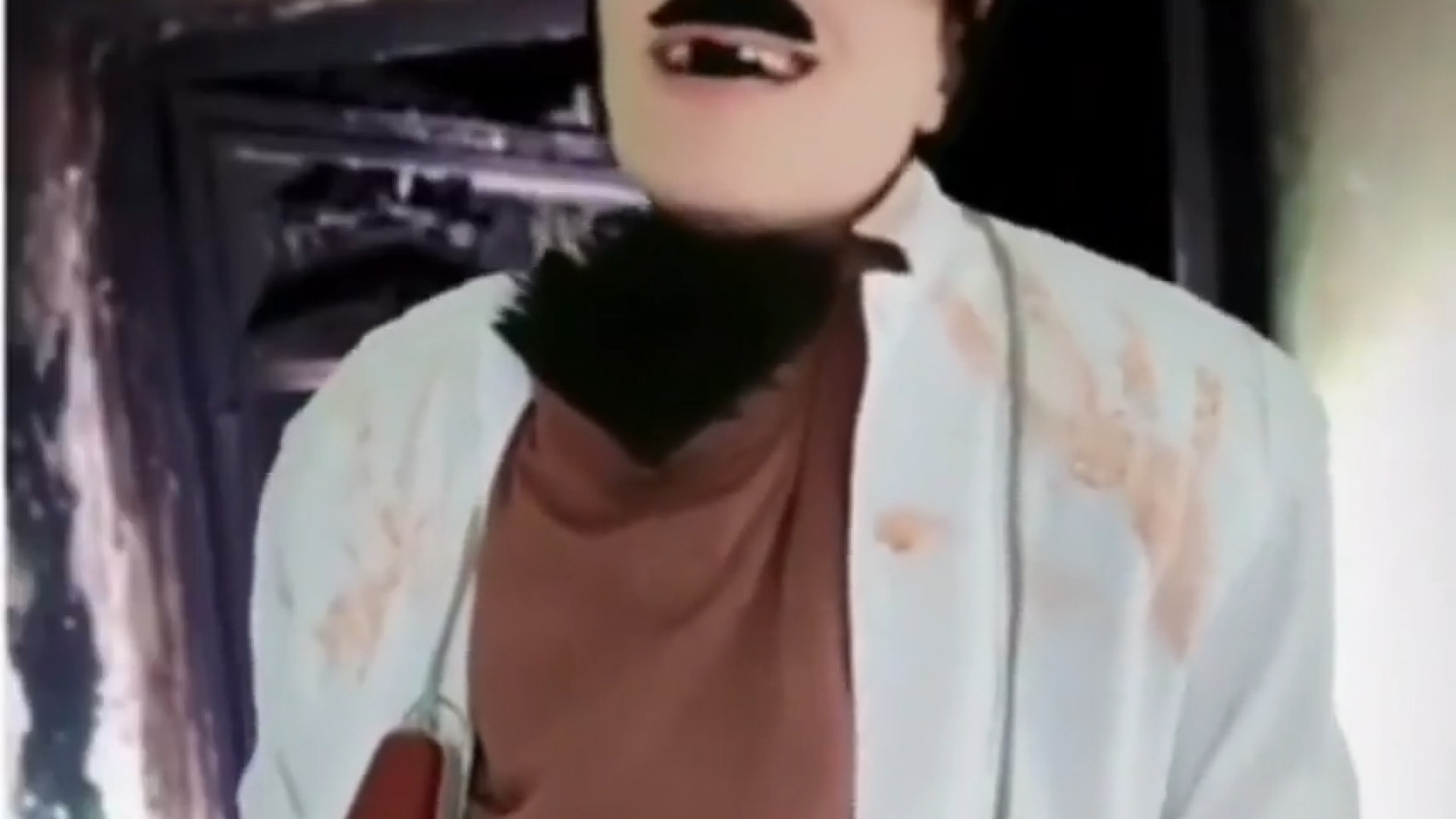 کلیپ طنز  ترس از دندانپزشکی  ت...