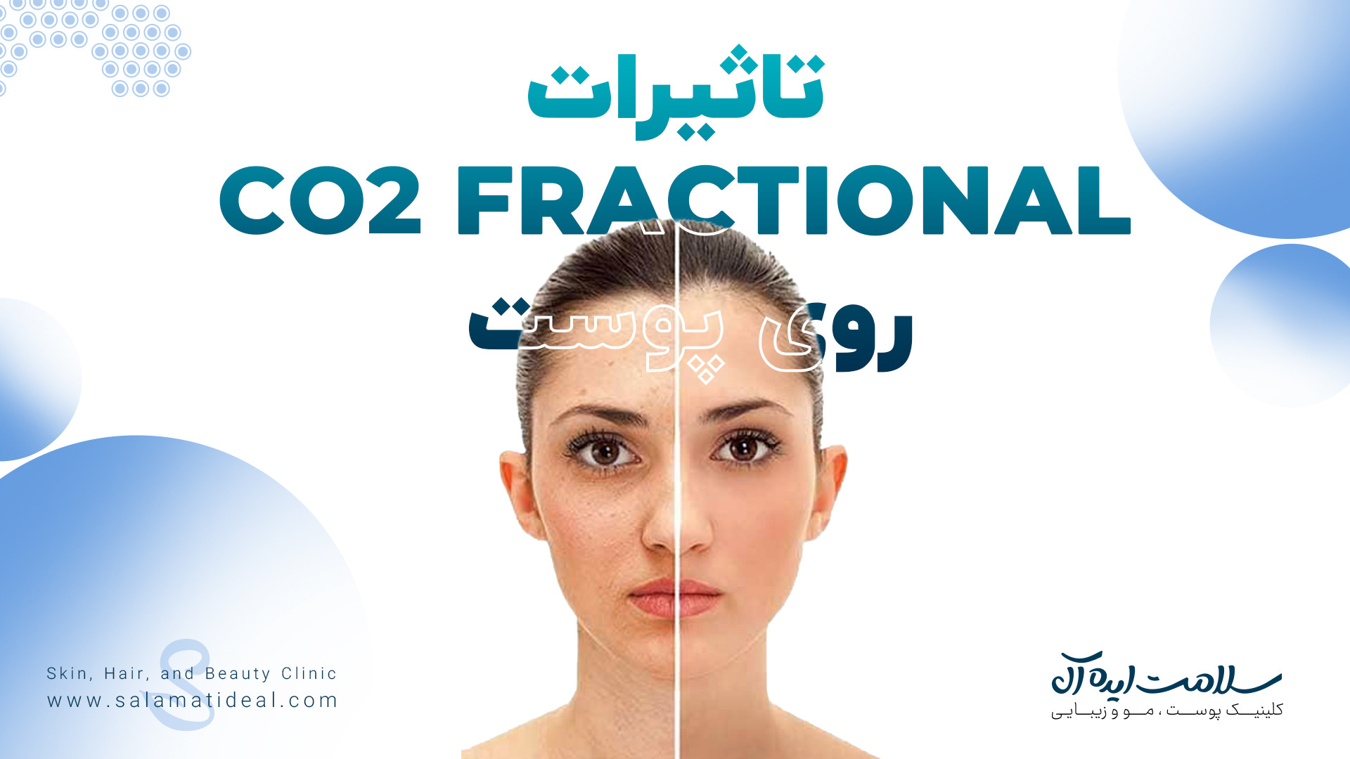 ویدیو آپارات ۲