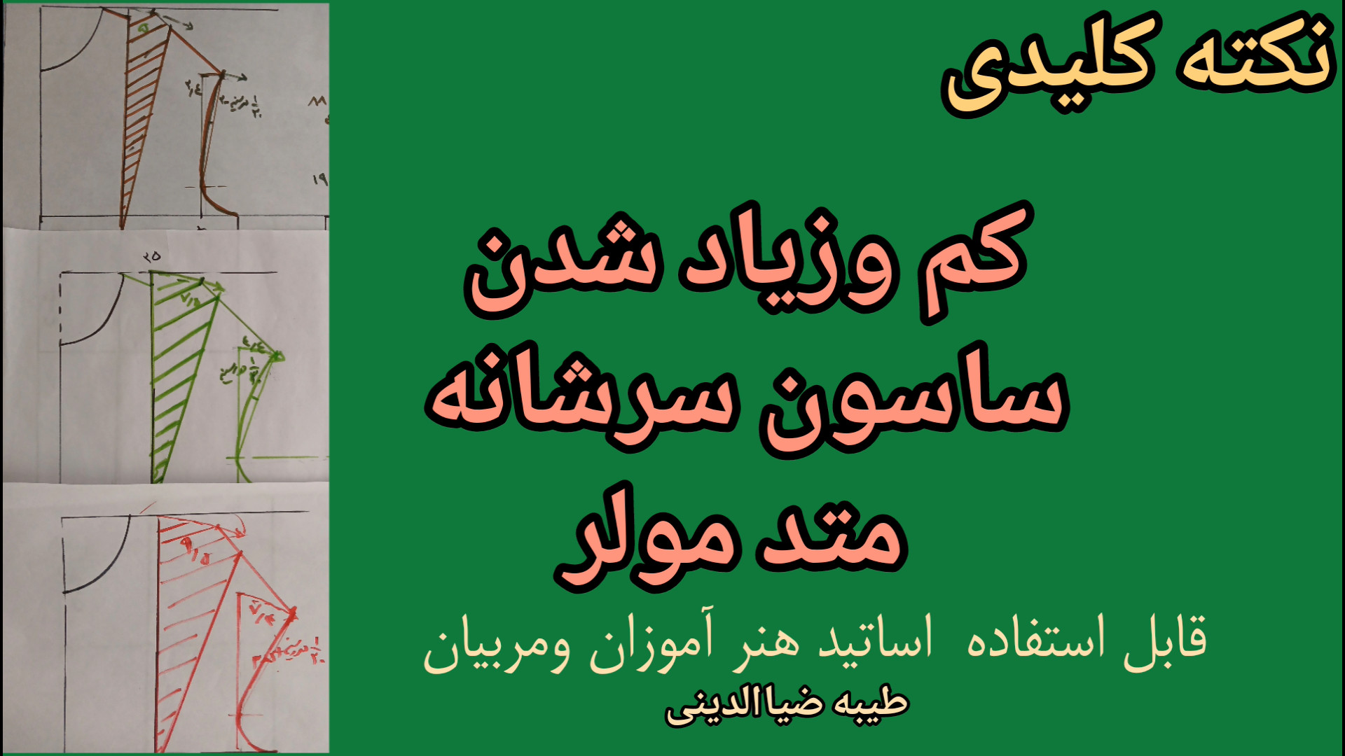 نکته کلیدی ساسون سرشانه مولر