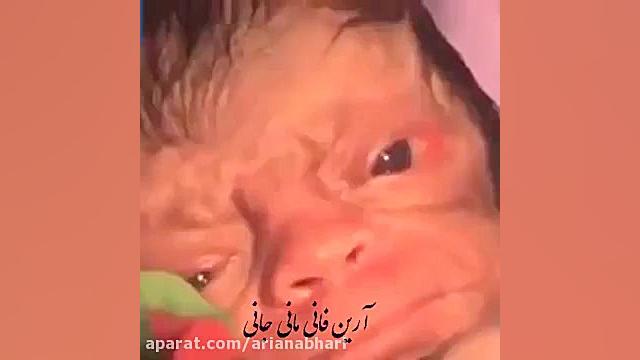 عجیب ترین بیماری نوزاد در لحظه...