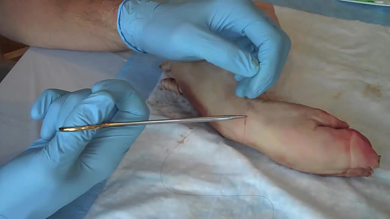 اموزش بخیه زدن